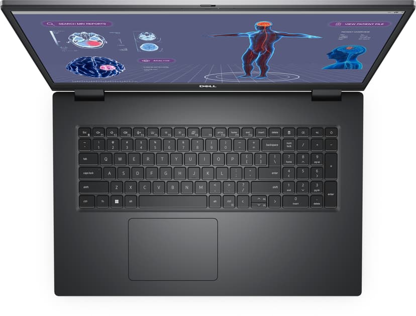 Dell Precision 7780 Core i7 32GB 1000GB RTX 3500 Ada 17.3"