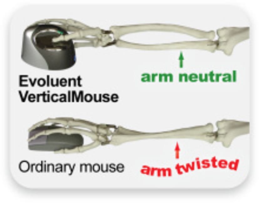 Evoluent Verticalmouse 4 Small USB-A Muis