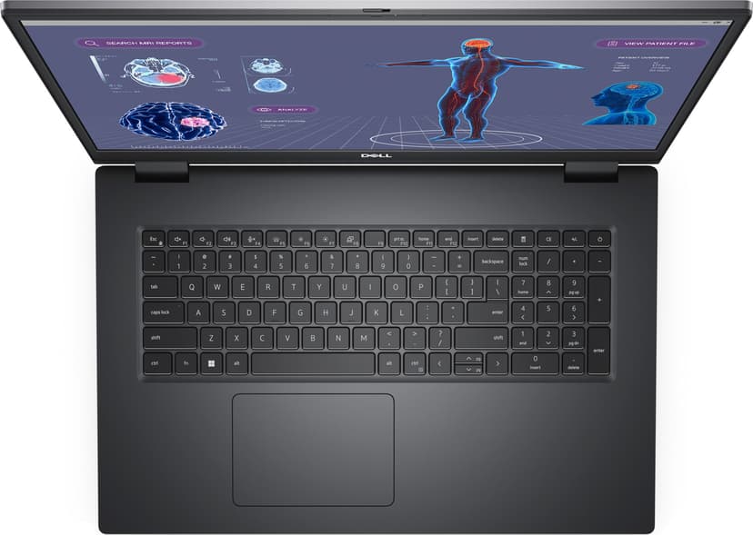 Dell Precision 7780 Intel Core i9 32GB 1000GB RTX 3500 Ada 17.3"