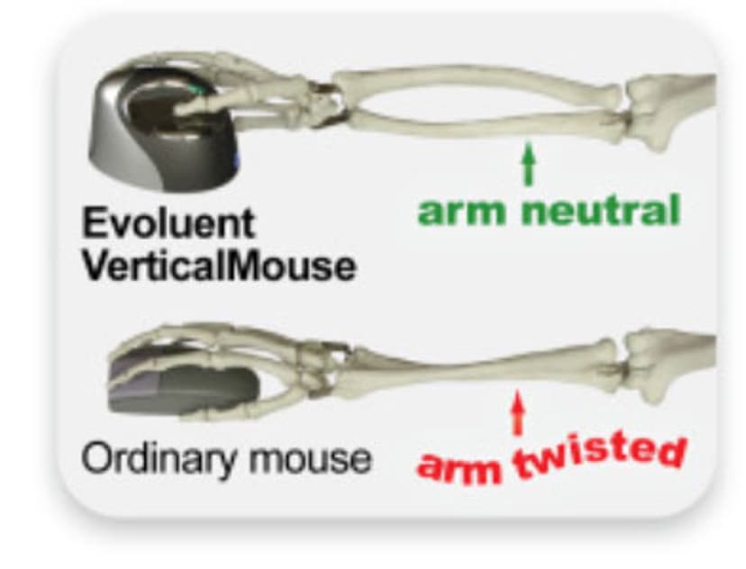 Evoluent Verticalmouse 4 Small Langaton RF Hiiri